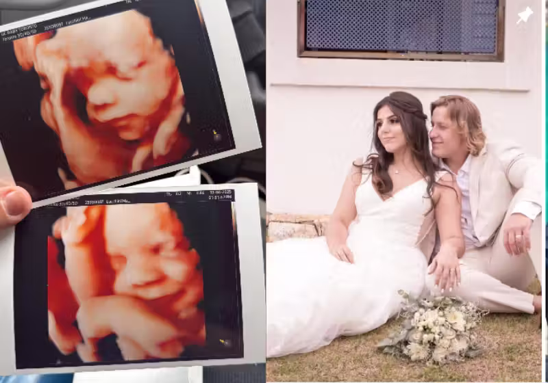 Giulia, essa bebê das fotos, sorri ao ouvir a voz do pai, enquanto a mãe brasileira faz o ultrassom da gravidez. Vídeo viral. - Foto: @sarahhlucchini